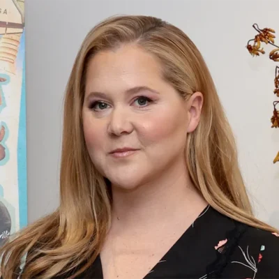 Amy Schumer Actriz Con El Sindrome De Cushing
